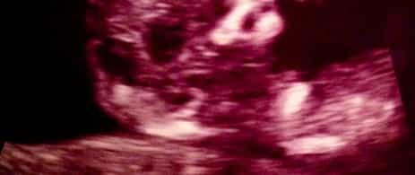 Photo: TV Star and Wife of Jonas Brother Shares Sonogram of New Baby Photo: TV Star and Wife of Jonas Brother Shares Sonogram of New Baby