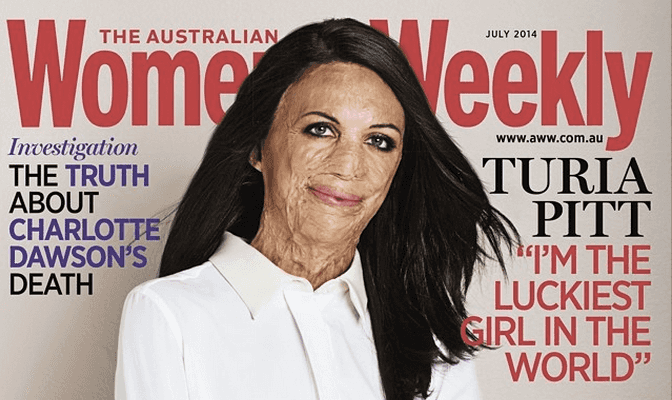 Could This Be The Most Important Magazine Cover Of The Year? Burns Victim Takes Front Cover Of Australian Women’s Magazine