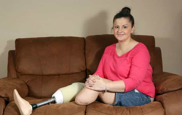 Glamputation Model: First Double Amputee Model Signs To UK Agency