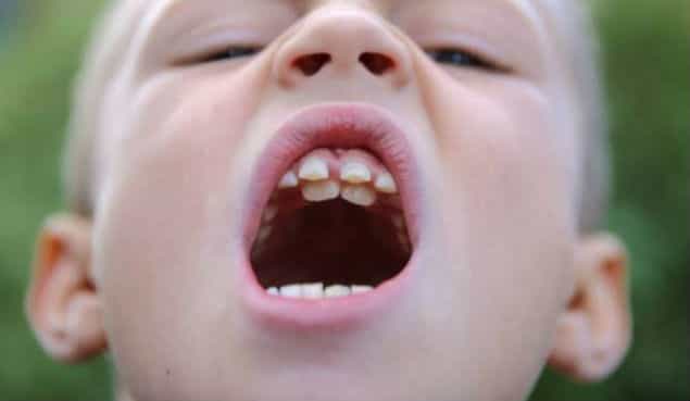 Schoolboy Proudly Shows Off His Second Set Of Teeth