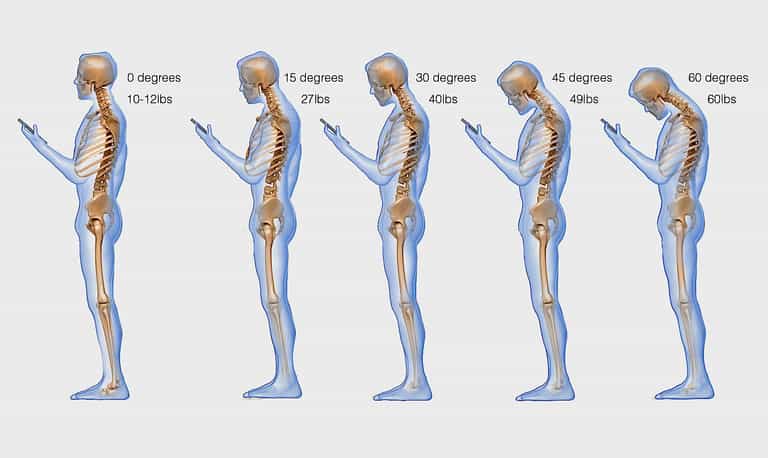 This is What Your Phone Addiction is Doing to Your Spine This is What Your Phone Addiction is Doing to Your Spine