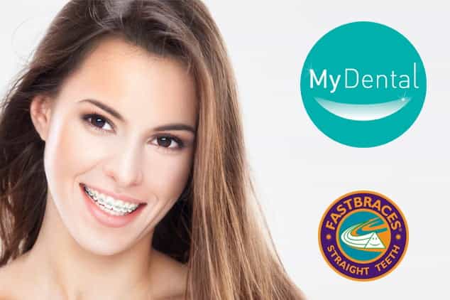 [CLOSED] Win! Straight Teeth In Six Months With Fastbraces!