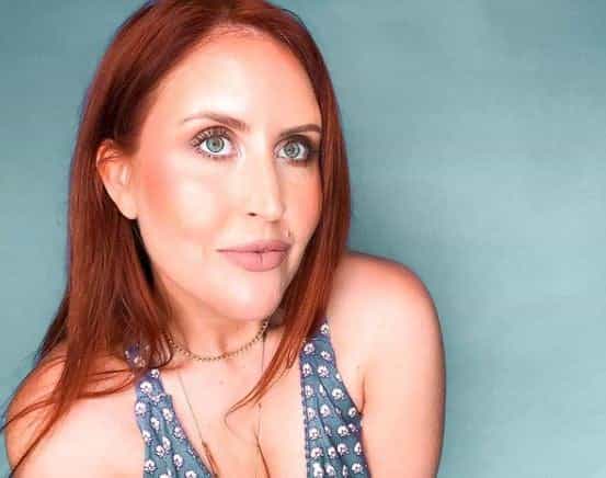 MAFS star Lauren shares story of “pimple” that turned out to be skin cancer MAFS star Lauren shares story of “pimple” that turned out to be skin cancer