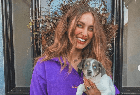Roz Purcell fractures leg in “freak accident”