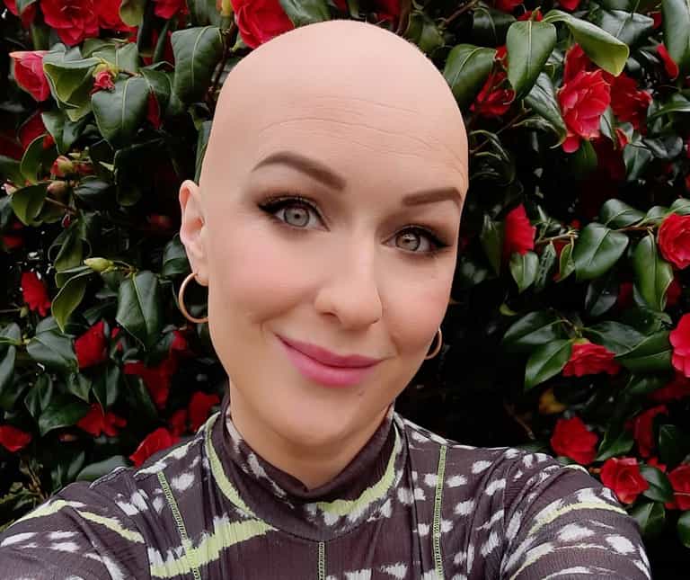 “It changed my relationship with beauty”: Journalist Mary Cate Smith discusses her alopecia journey “It changed my relationship with beauty”: Journalist Mary Cate Smith discusses her alopecia journey