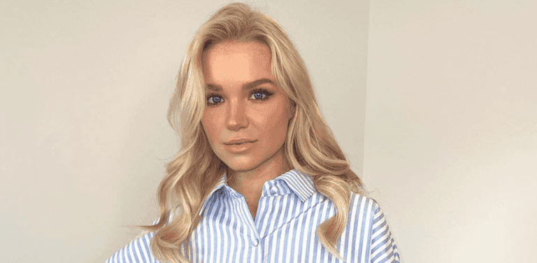 Abbie Quinnen praised for bravely showing scars following fire stunt with AJ Pritchard