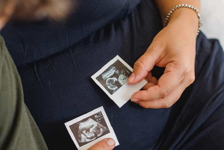 “A big surprise”: Mum welcomes four babies in the one year