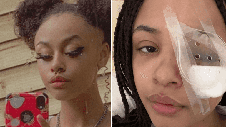 Gardaí appeal for witnesses following assault on teenage girl