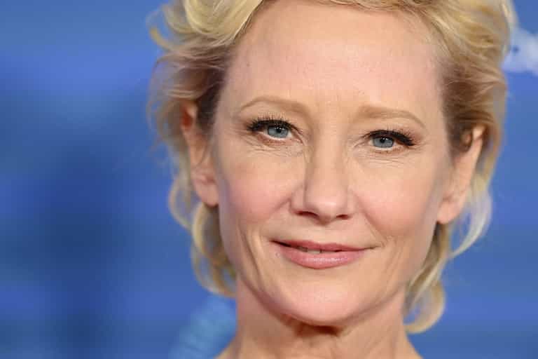 Actress Anne Heche “not expected” to survive coma