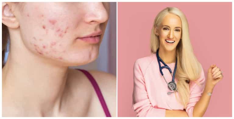 Dr Doireann O’Leary’s top tips on managing acne prone skin and breakouts