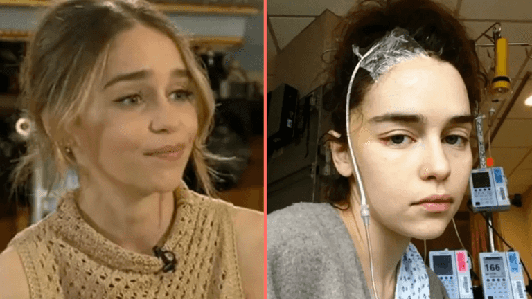Emilia Clarke missing ‘quite a bit’ of her brain after two aneurysms and is ‘surprised’ she can speak Emilia Clarke missing ‘quite a bit’ of her brain after two aneurysms and is ‘surprised’ she can speak