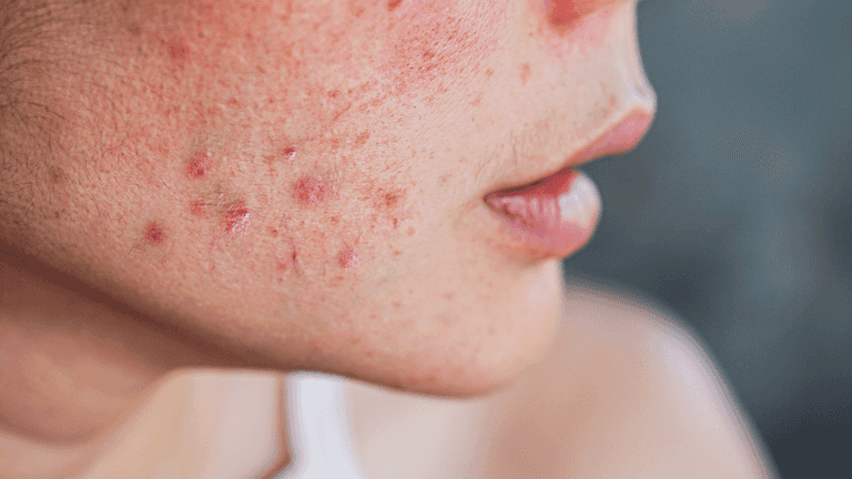 ‘I made a major skincare mistake this month that you need to be wary of’