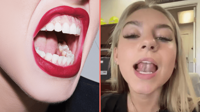 ‘Gleeking’ is the ‘disgusting’ bodily function that most people don’t know they can do