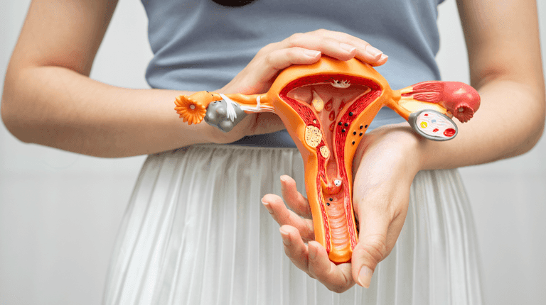 What is PCOS and why has it been renamed?