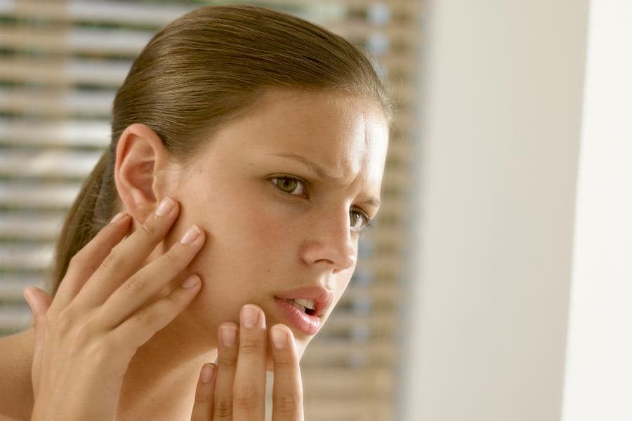 Find Out How to Tackle These Top Five Beauty Party Poopers