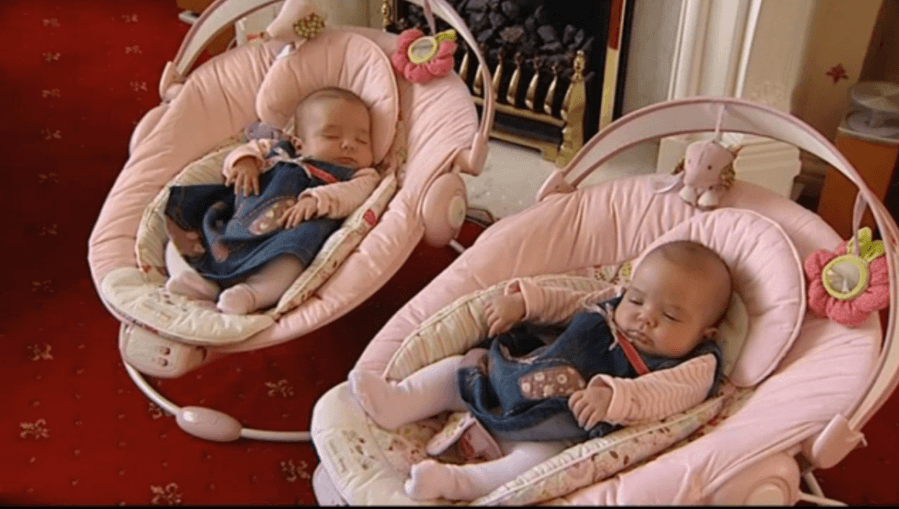 ‘Bubbly’ Conjoined Twins Successfully Separated In A London Hospital