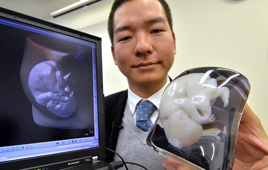 Technology Is Getting Creepy: Would You Invest In Your Very Own Foetus Replica Keyring?
