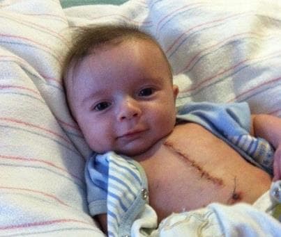 Have You Met Ridiculously Good Looking Surgery Baby?