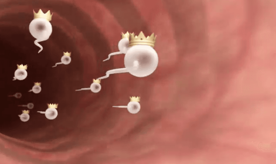 Royal Sperm With Crowns, We’re Not Joking You: This Is One Kate And Will Pregnancy News Report You Won’t Forget