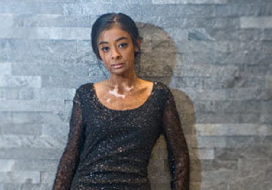 Beauty Is More Than Just Skin Deep: One Young Girl And A High-Street Fashion Giant Break The Mould