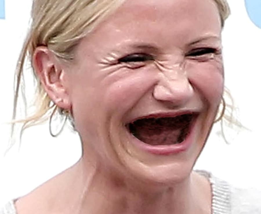 Say Cheese: 13 Actresses Without Teeth