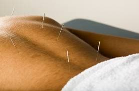 “I’m a Therapist, Not a Prostitute!” – Irish Acupuncturist Hits Back After Series of Lewd Responses to Advert
