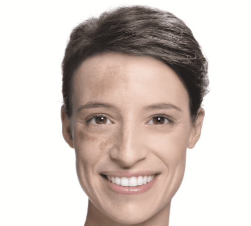 Clear as Day: The Dos & Don’ts of Imperfection Prone Skin