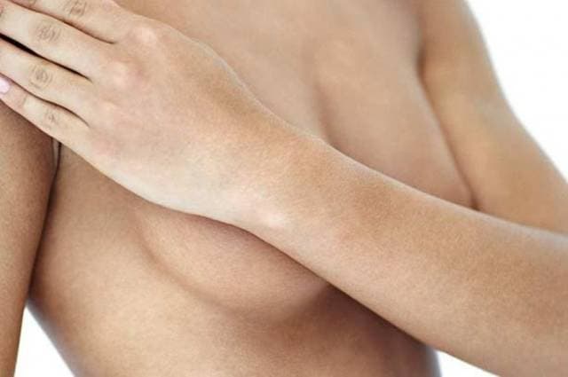“The Destination Is The Woman’s Wellbeing”: Breast Reconstruction Organisation To Host Fantastic Fundraising Event In Dublin
