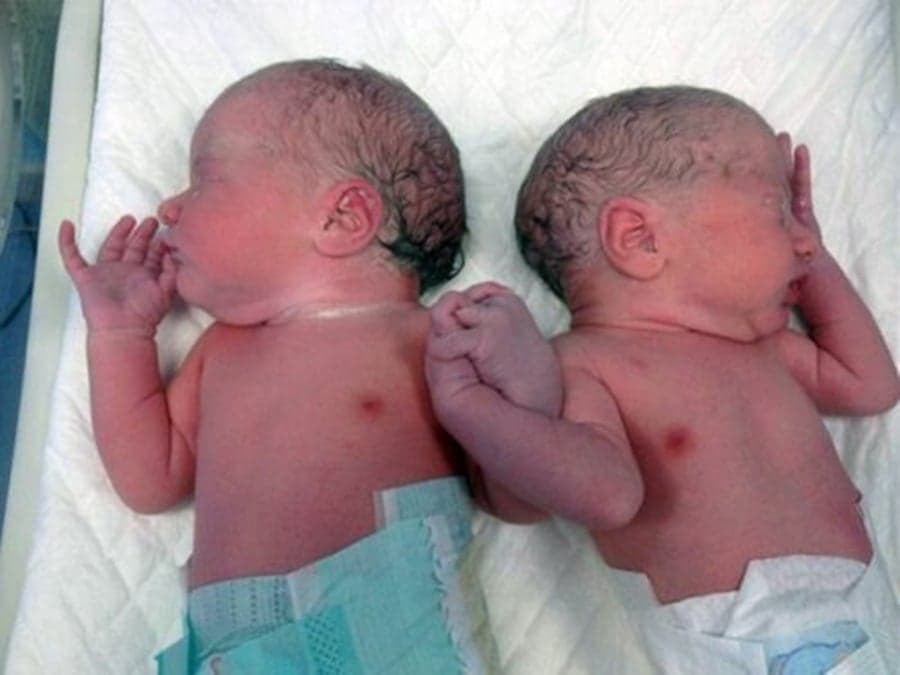 Don’t Let Go: Incredible Picture Of Twins Holding Hands Minutes After Birth