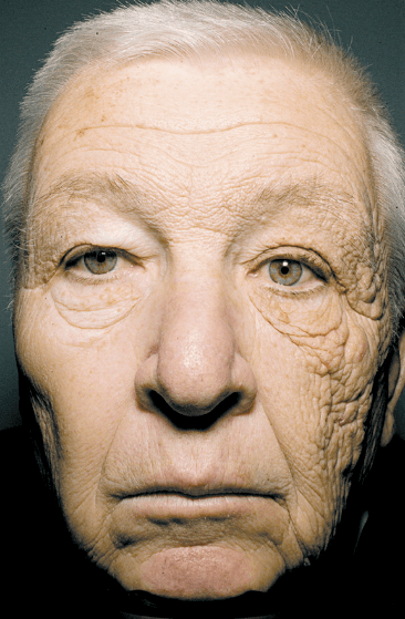 PIC: The Most Compelling Argument for Suncreen You’ll Ever See