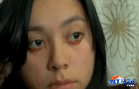 Family Appeal for Financial Support to Help Chilean Woman Who Cries Tears of Blood