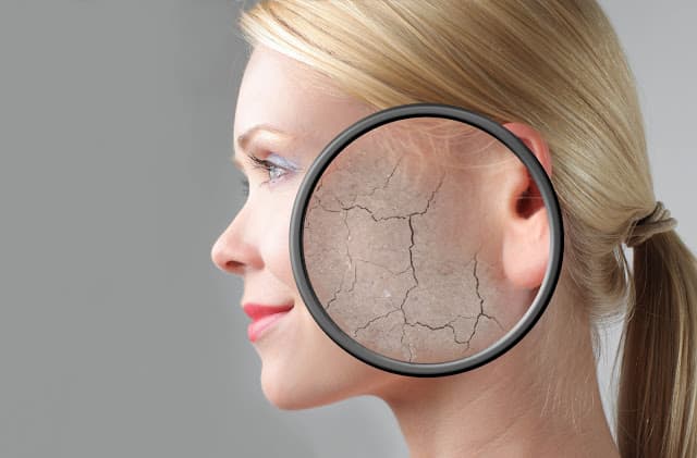 Putting Your Best Face Forward – Top Tips For Dry Skin
