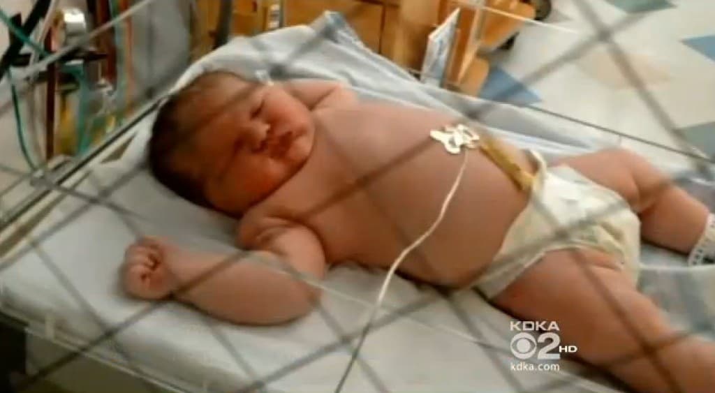 What a Bundle! American Woman Gives Birth to 14 Pound Baby