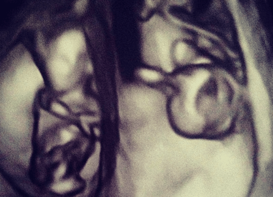 Actress Reveals She Is Expecting Twins By Sharing Sonogram