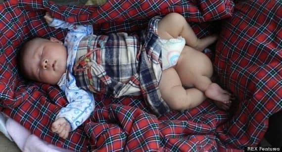 PICTURE: Three-Legged Baby Born In China