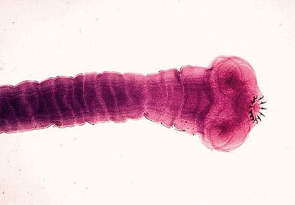 Desperate To Lose Weight: Woman Swallows Tapeworm In A Bid To Get Skinny