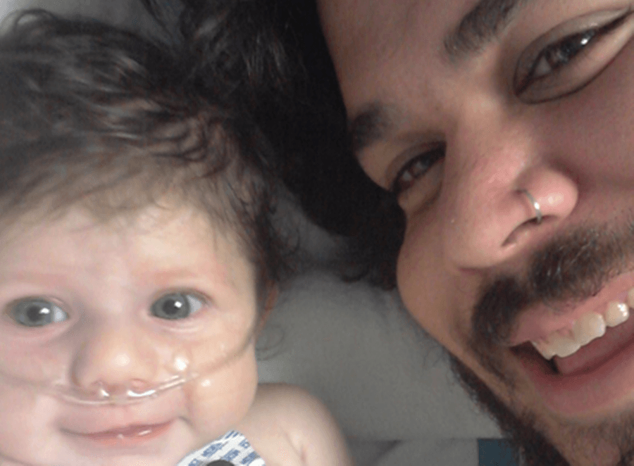 Dad Shares Picture Before Daughter’s Open Heart Surgery