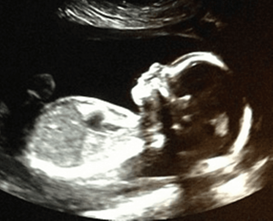 “Happy and Excited” – Singer Shares Sonogram Snap On Instagram