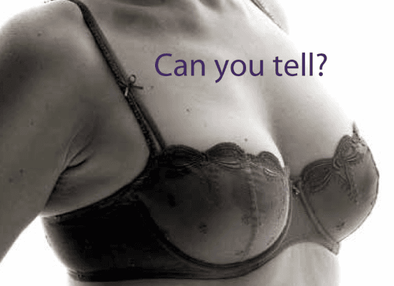 Open Evening Set to Highlight Major Advances in Breast Reconstruction Surgery for BRA Day