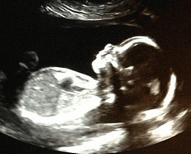 “The Most Incredible Moment of my Life!”: R&B Singer Announces Birth of Baby Daughter