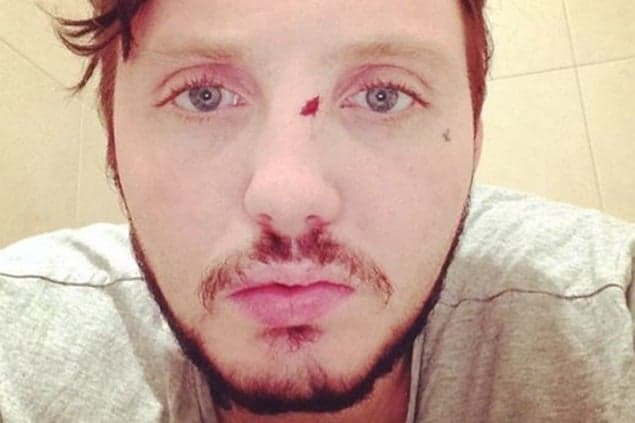 X Factor Star Involved In Bar Brawl In Poland