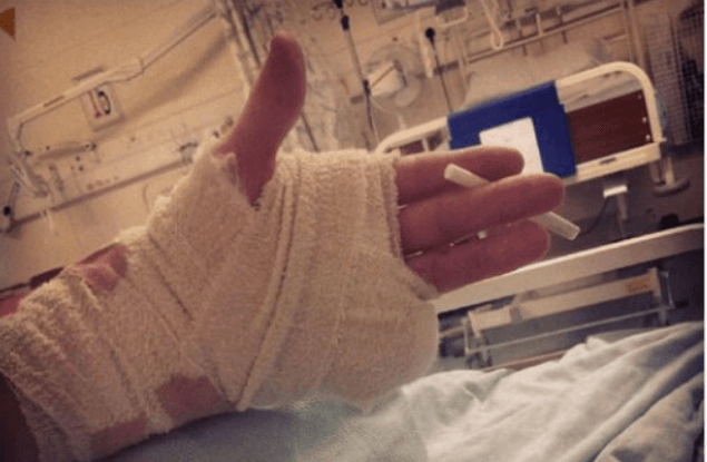‘Rave F*cked Me Up #rumnbass Want Ma Finger Back’ – Teen Posts Snap of Hand After He Severs Finger At Rave