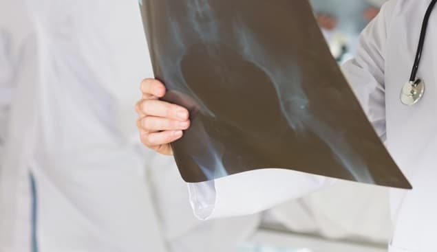 Doctors Find Sex Toy In Woman’s Vagina… Oh, And It Had Been There For 10 Years