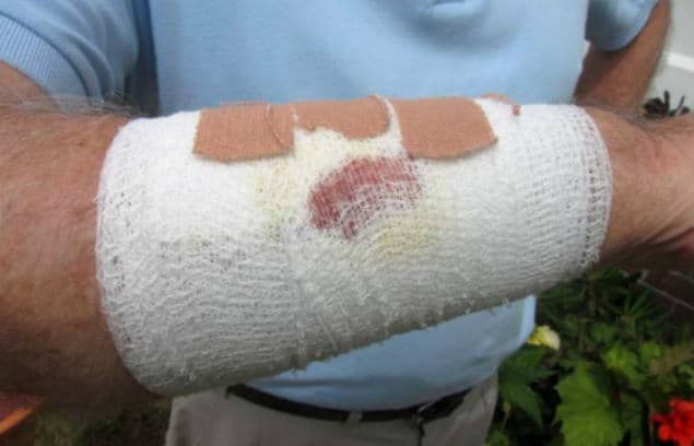 Proof That Cats Are Evil – Stray Moggy Attacks Couple And Destroys Home