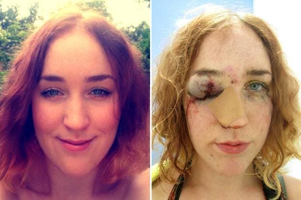 Woman Shares Selfie After Being Punched In The Face For “Telling Man To Stop Groping Her”