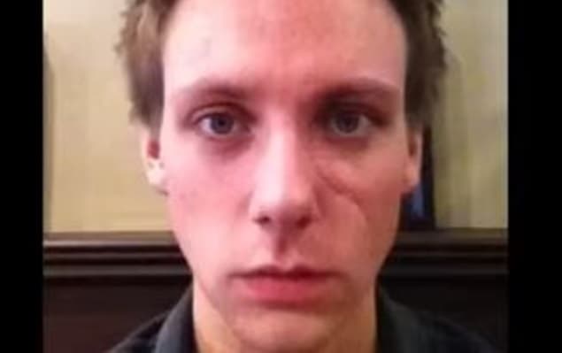 Time-Lapse Video Shows Guy’s Recovery After He Is “Glassed” in the Face