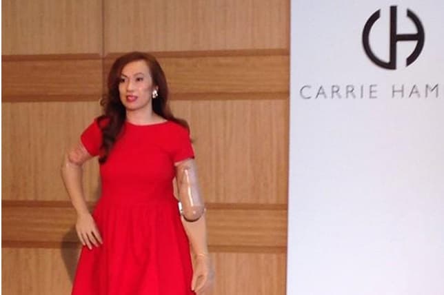 Quadruple Amputee Model Makes Fashion Week History