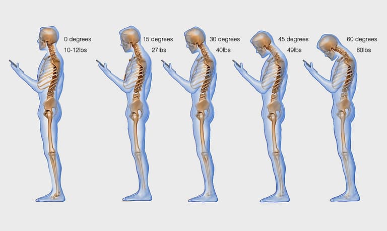 This is What Your Phone Addiction is Doing to Your Spine This is What Your Phone Addiction is Doing to Your Spine