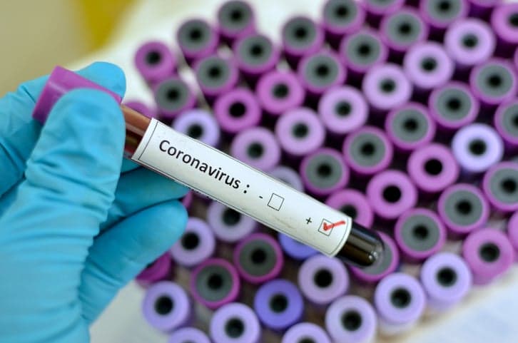 Northern Ireland records first death of patient with Covid-19