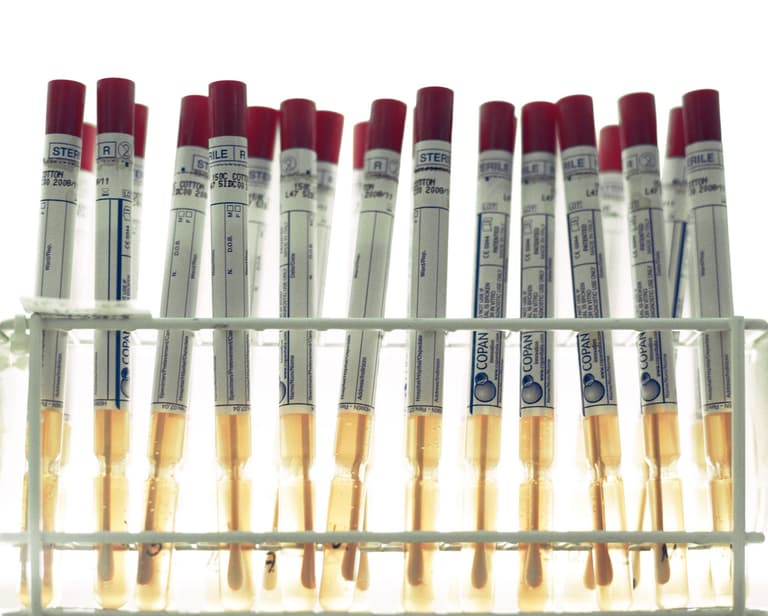 Home smear tests to be trialled by thousands in the UK